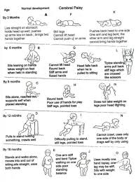 Developmental Stages Normal Vs Cerebral Palsy Fig A E