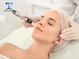 Kiến thức tổng quan về phương pháp phi kim tế bào gốc