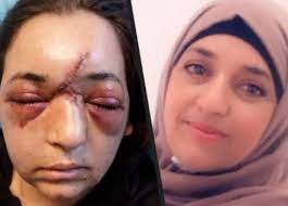 Pesan wanita palestina untuk wanita indonesia. Tentara Israel Pecahkan Tengkorak Seorang Wanita Palestina Islam Times