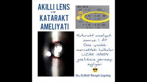 Omurluk Akilli Lens Fiyatlari 2020 Yili Guncel