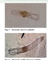 Image result for Demodex brevis