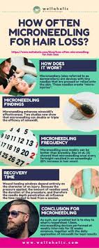 We did not find results for: How Often Microneedling For Hair Loss