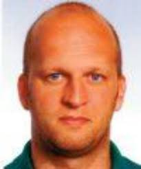 Miniscrews in the Anterior Palate