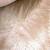 Lice In Blonde Hair