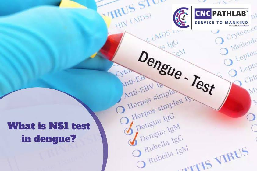 DENGUE NS1 product image