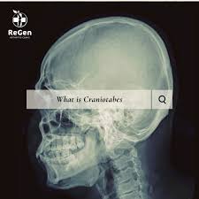 Image result for Craniotabes