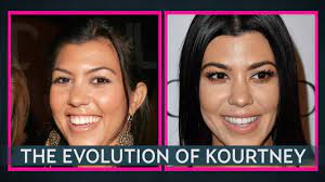 On friday, kardashian, 41, posted an instagram. See How Kourtney Kardashian S Face Has Changed Youtube