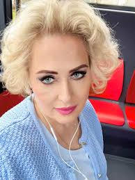 верхняя и нижняя блефаропластика. швы сняты, отёки тоже ушли. в лоб ботокс.  рекомендации лучших собаководов.