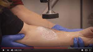 Treating Chemical Burns | 2017-02-26 | Safety+Health