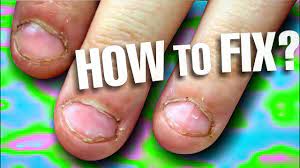 Another tip to make short nails appear longer is to avoid painting all the way to the edge of the nail on both i don't bite my nails but i pick at them with my fingers. Nails Bitten How To Fix Nails At Home Simple Nail Art Pedicure Beauty Hacks Best Nail Education Youtube