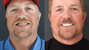 Person 2 Person: Ryan Shupe