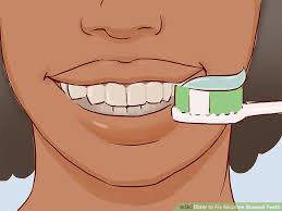 See full list on wikihow.com Black Stains On Teeth From Smoking Teethwalls