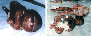 The discussion covers cases of minimal risk due to external irradiation resulting from the storage and handling of depleted uranium ammunition and, in contrast. Pdf Depleted Uranium Its Nature Characteristics And Risks Of The Military Uses On Humans And The Environment Semantic Scholar