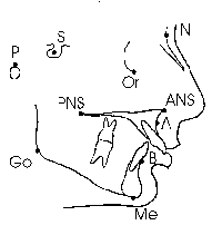 Banobagi's two jaw surgery does not require second surgery for pin removal. Https Www Blueshieldca Com Bsca Bsc Public Common Portalcomponents Provider Streamdocumentservlet Filename Prv Orthoganthic Surg Pdf
