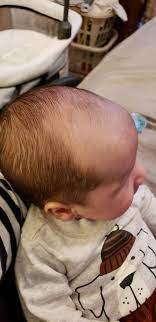 My baby was born with a full head of straight dark hair. Newborn Baby Hair Falling Out Newborn Baby