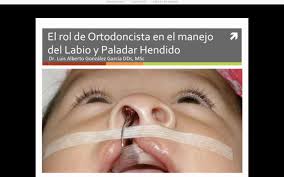 El labio leporino y paladar hendido pueden manifestarse de la siguiente manera por lo general, el labio leporino y paladar hendido se detectan en el nacimiento, y el médico puede comenzar a. Idap Webinar Gratuito El Rol Del Ortodoncista En El Manejo Del Labio Y Paladar Hendido Facebook