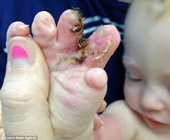 North Carolina four-year-old creates 9 3D printed prosthetic hands for  himself