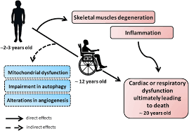 Duchenne muscular dystrophy (dmd) is occurs when the dmd gene is not working correctly. The Pathology Of Duchenne Muscular Dystrophy Dmd The Progression Of Download Scientific Diagram