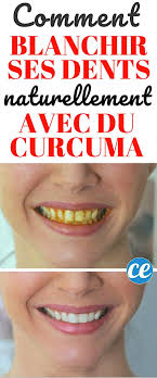 Comment Blanchir Les Dents Jaunes Avec Du Curcuma 100 Naturel Et Efficace Comment Blanchir Les Dents Blanchir Les Dents Dents Jaunes