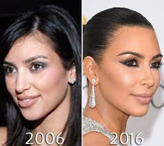 Kim Kardashian Nose Before And After Photo Kardashian Plastic Surgery Kim Kardashian Before Kim Kardashian Hair