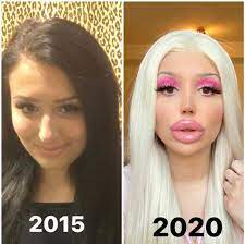 Bimbofication before and after