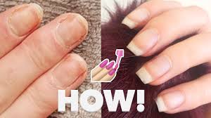 So your nails are officially damaged—now what? How I Fixed My Damaged Nails Youtube