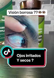 Vitaminas para los ojos #eyes #vitamins #visionborrosa #ojosrojos #fatiga  #healthy #eyecare #zooone #newyearnewaura #tiktokshop