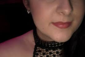 What it's like living with arthritis in your 20s