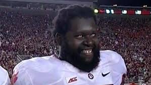 Clemson guard's eyes are the stuff of nightmares