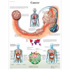 cancer chart