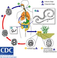 Ascariasis Wikipedia