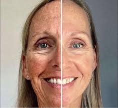 Common reasons skincare routines fail and solutions