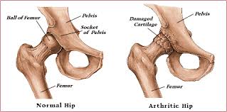 The deep muscles of the hip include the piriformis, the obturator internus, the obturator externus, the gemellus superior, the gemellus inferior and the quadratus femoris. Hip Joint Anatomy Hip Bones Ligaments Muscles