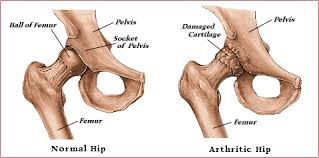 Found a human leg bone underwater in the river! Hip Joint Anatomy Hip Bones Ligaments Muscles