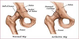 These muscles are found deep within our abdominal area and are some of the strongest muscles in our body, ultimately providing our core support and hip flexors allow you to bend your knee and flex your hip. Hip Joint Anatomy Hip Bones Ligaments Muscles