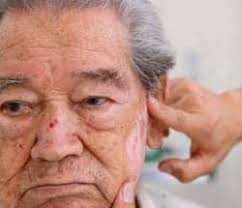 Oncology, Genetic Testing Advance with Synergy