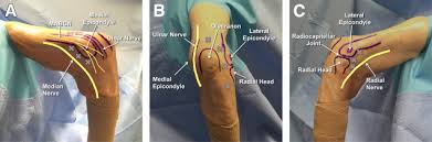 The rounded protuberance at the end of a bone which is most often part of a joint or an attachment with another bone is called condyle. Basics Of Elbow Arthroscopy Part I Surface Anatomy Portals And Structures At Risk Sciencedirect