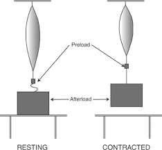 Image result for Preload