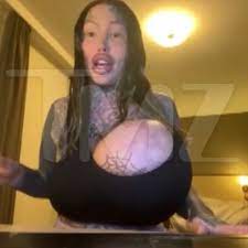 Uni-Boob IG Model Says She's Not Mentally Ill, Surgery Is Her 'Extreme  Sport'
