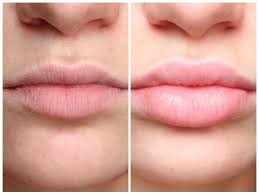 How to make your lips soft. Natural Ways To Make Your Lips Pink In 4 Days Health Gadgetsng