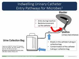 Urinary Catheter Types And Care For Residents With Catheters