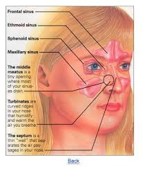 Balloon Sinuplasty Unblocking Your Sinuses For Solutions To Chronic Sinusitis How Does It Work A Small Tube I Sinus Remedies Sinus Surgery Sinus Problems