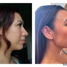 TOP 10 BEST Hair Botox in Evansville, IN