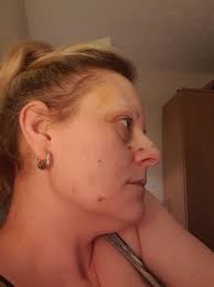 My toyboy lover punched my head & twisted my neck as I held our baby in  Xmas Eve assault