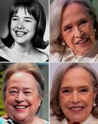 Actress fights cancer and lymphedema publicly