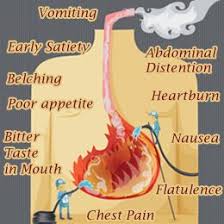 Bitter Taste In My Mouth And Nausea Pin On Health Fitness