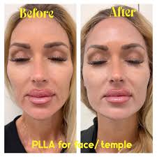 حبي_نفسك #dr_alaa_osman