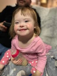 Dance class helps child with muscle defect walk