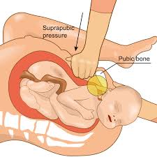 Image result for Shoulder Presentation