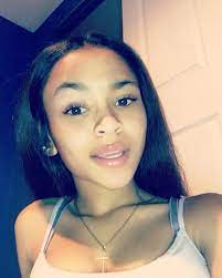 I Got A Scar On My Cheek Light Skin Girls Cute Mixed Girls Pretty Lightskins Girls With Braces